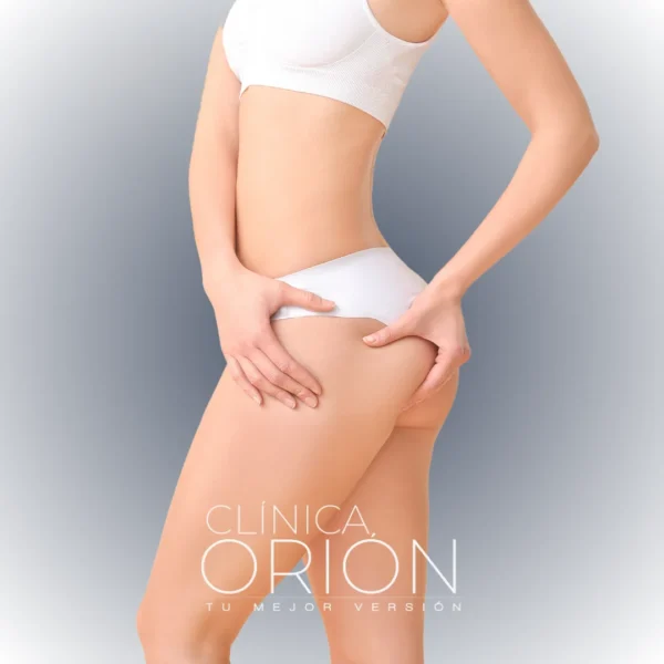 Aumento de Gluteos