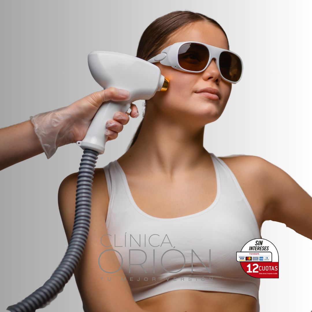 imagenes para web Orion (9)